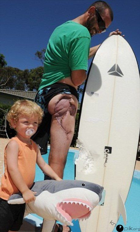 Австралийский серфер выжил после нападения акулы