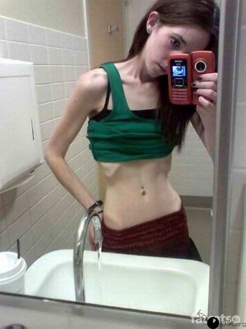 Anorexic Girl Fucks